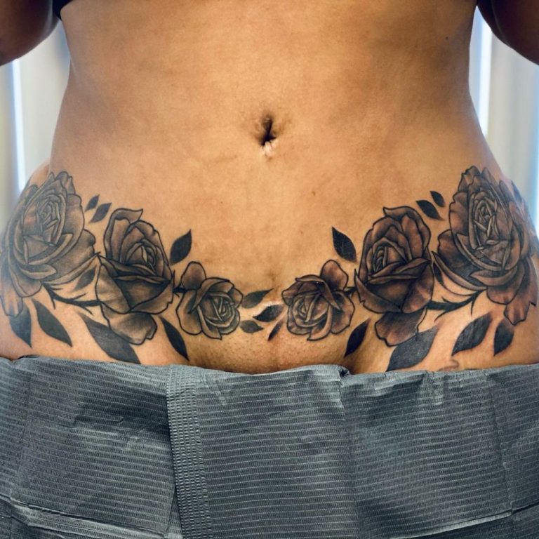 Abdominoplasty Scar Tattoos